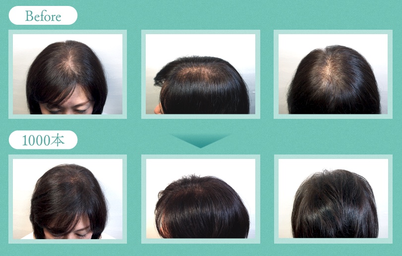 ビフォー・アフター