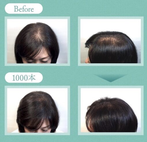 ふわヘア(ボリュームアップヘア増毛エクステンション)